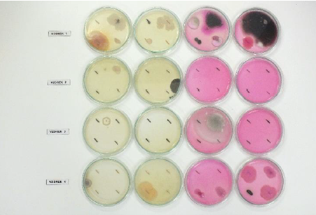 Konec mykologické kultivační analýzy